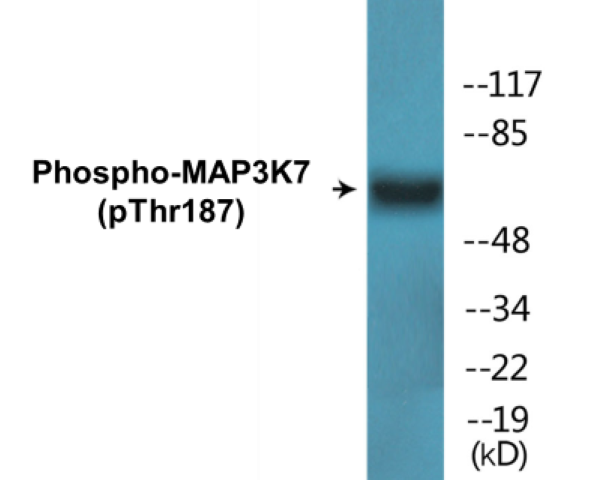 MAP3K7 (phospho Thr187) Cell Based ELISA Kit