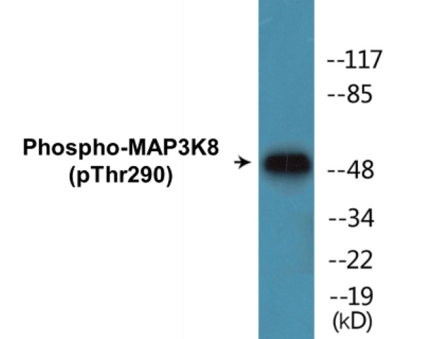 MAP3K8 (phospho Thr290) Cell Based ELISA Kit