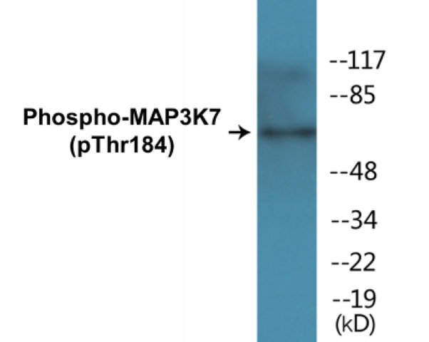 MAP3K7 (phospho Thr184) Cell Based ELISA Kit