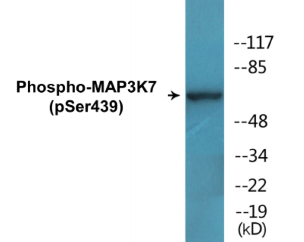 MAP3K7 (phospho Ser439) Cell Based ELISA Kit