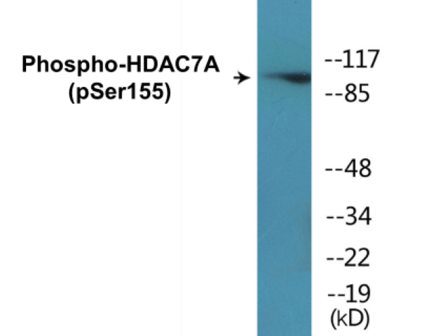 HDAC7A (phospho Ser155) Cell Based ELISA Kit