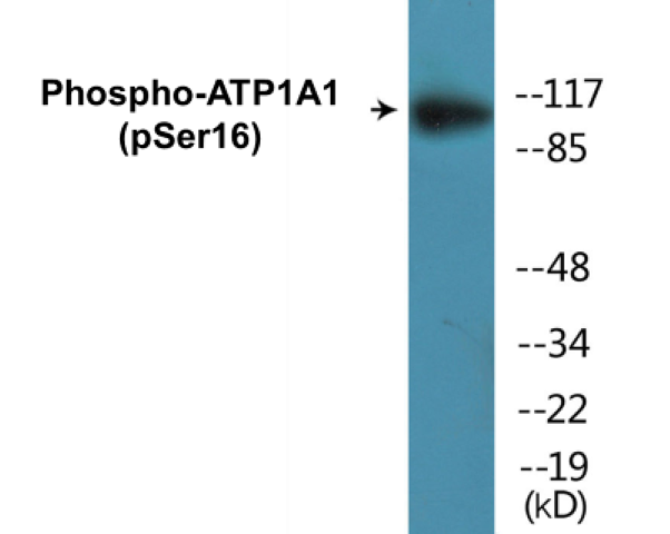 ATP1A1 (phospho Ser16) Cell Based ELISA Kit