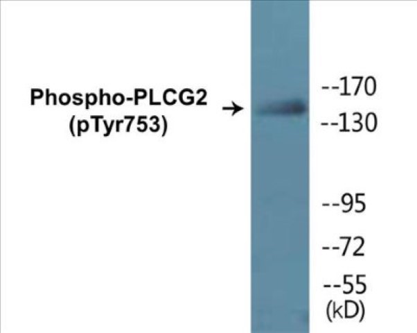 PLCG2 (phospho Tyr753) Cell Based ELISA Kit