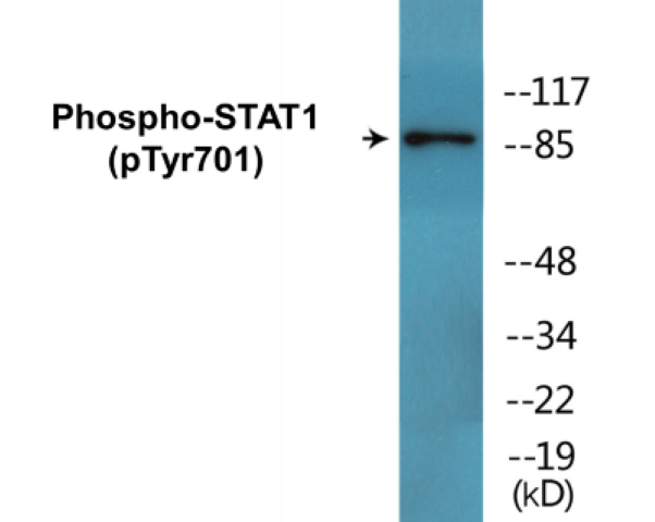 STAT1 (phospho Tyr701) Cell Based ELISA Kit