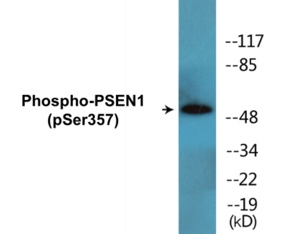 PSEN1 (phospho Ser357) Cell Based ELISA Kit