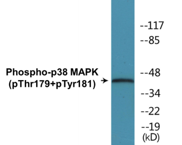 p38 MAPK (phospho Thr179+Tyr181) Cell Based ELISA Kit