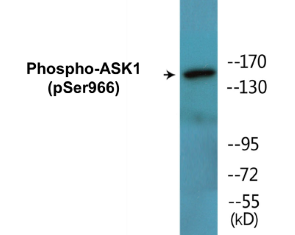 ASK1 (phospho Ser966) Cell Based ELISA Kit