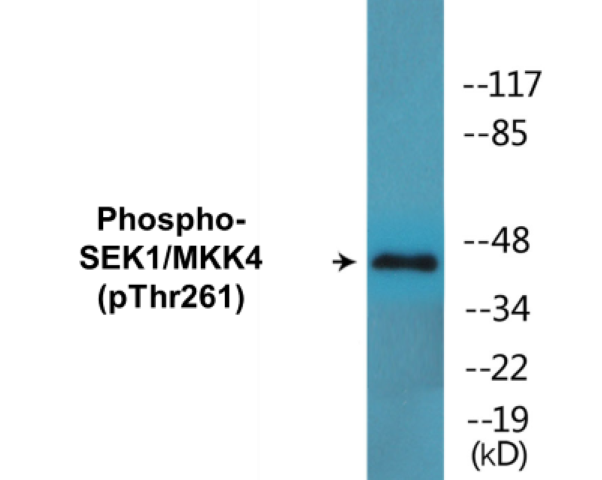 SEK1 (phospho Thr261) Cell Based ELISA Kit