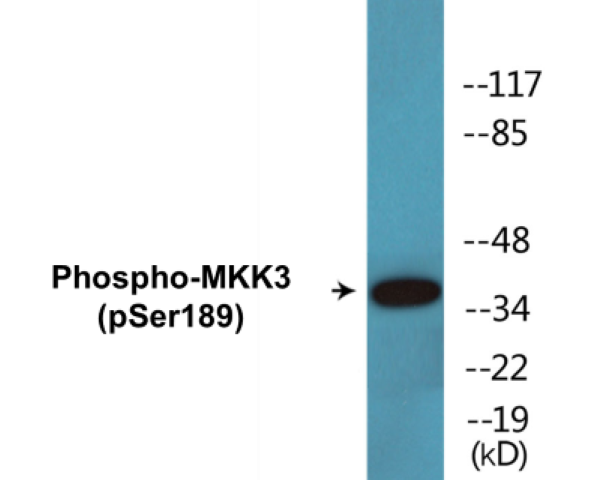 MKK3 (phospho Ser189) Cell Based ELISA Kit