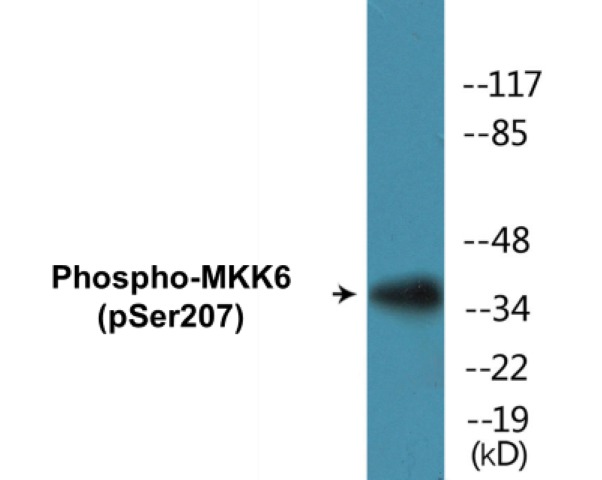 MKK6 (phospho Ser207) Cell Based ELISA Kit