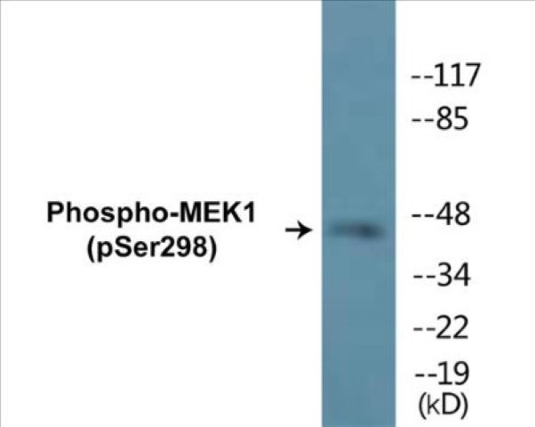 MEK1 (phospho Ser298) Cell Based ELISA Kit