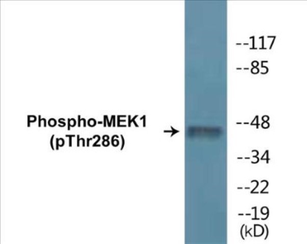 MEK1 (phospho Thr286) Cell Based ELISA Kit