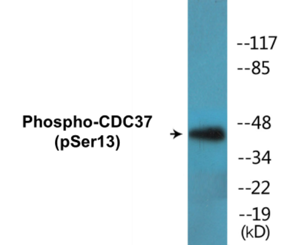 CDC37 (phospho Ser13) Cell Based ELISA Kit