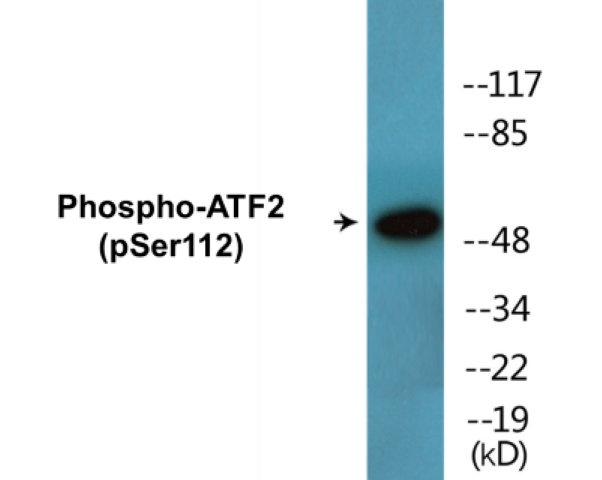 ATF2 (phospho Ser112) Cell Based ELISA Kit