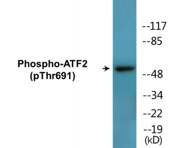 ATF2 (phospho Thr691) Cell Based ELISA Kit