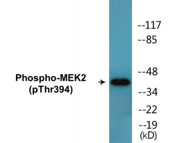 MEK2 (phospho Thr394) Cell Based ELISA Kit