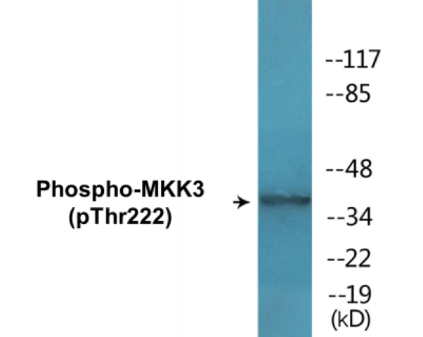 MKK3 (phospho Thr222) Cell Based ELISA Kit