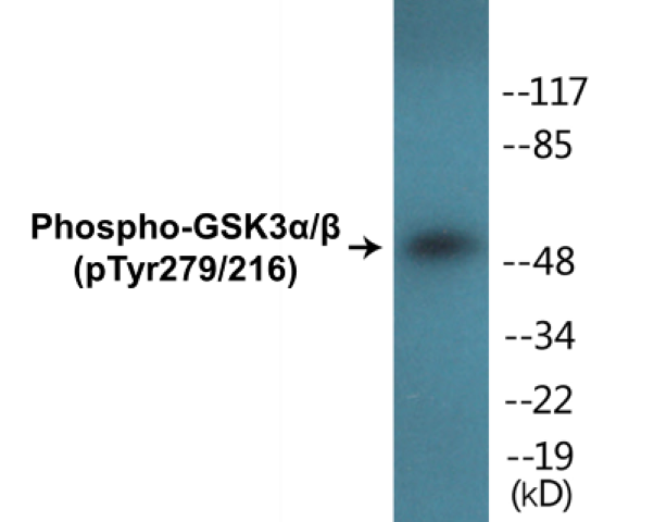 GSK3 alpha + beta (phospho Tyr279 + Tyr 216) Cell Based ELISA Kit