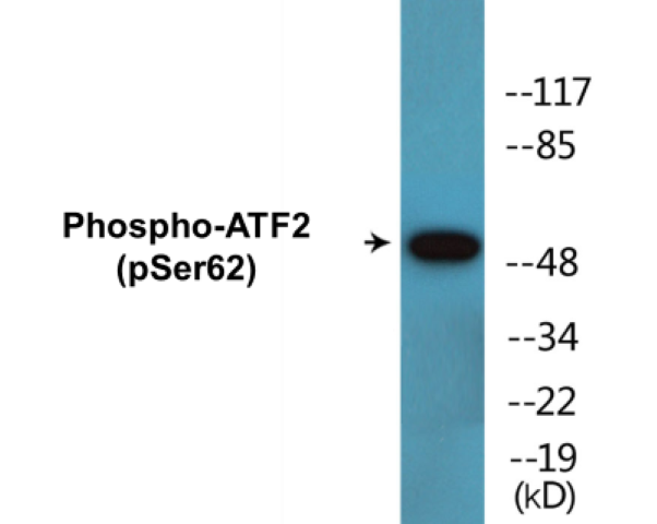 ATF2 (phospho Ser62) Cell Based ELISA Kit