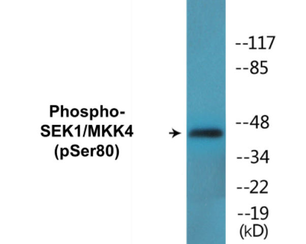 SEK1 (phospho Ser80) Cell Based ELISA Kit