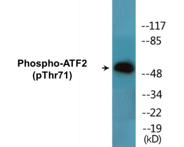 ATF2 (phospho Thr71) Cell Based ELISA Kit