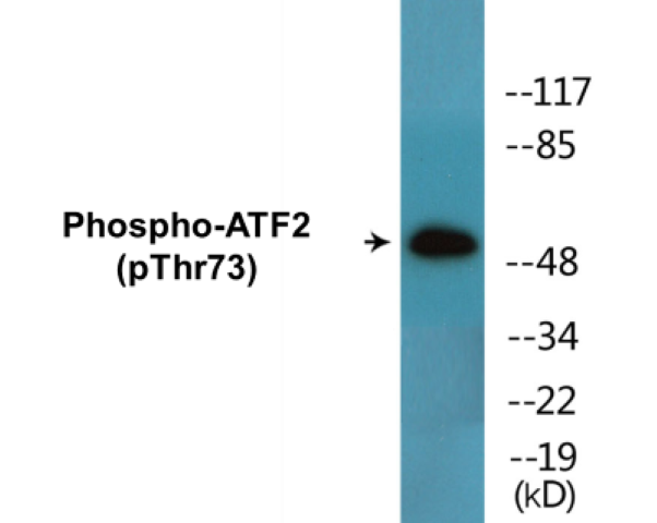 ATF2 (phospho Thr73) Cell Based ELISA Kit