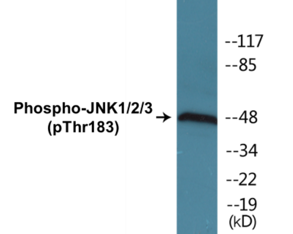 JNK1 + 2 + 3 (phospho Thr183) Cell Based ELISA Kit