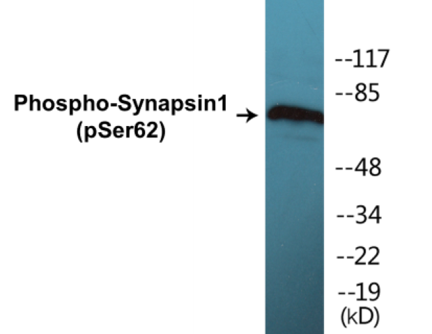 Synapsin 1 (phospho Ser62) Cell Based ELISA Kit