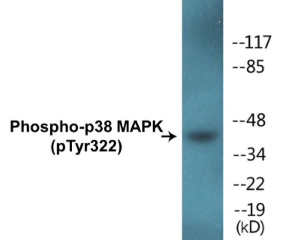 p38 MAPK (phospho Tyr322) Cell Based ELISA Kit