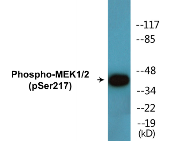 MEK1 + 2 (phospho Ser217) Cell Based ELISA Kit