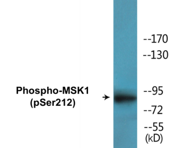 MSK1 (phospho Ser212) Cell Based ELISA Kit