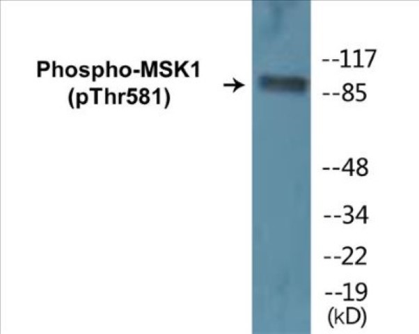 MSK1 (phospho Thr581) Cell Based ELISA Kit