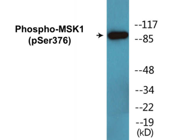 MSK1 (phospho Ser376) Cell Based ELISA Kit