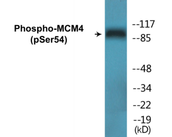 MCM4 (phospho Ser54) Cell Based ELISA Kit