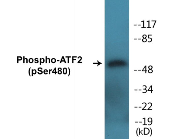 ATF2 (phospho Ser480) Cell Based ELISA Kit