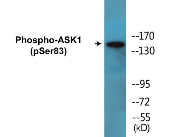 ASK1 (phospho Ser83) Cell Based ELISA Kit