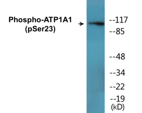 ATP1A1 (phospho Ser23) Cell Based ELISA Kit