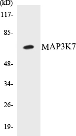 MAP3K7 Cell Based ELISA Kit