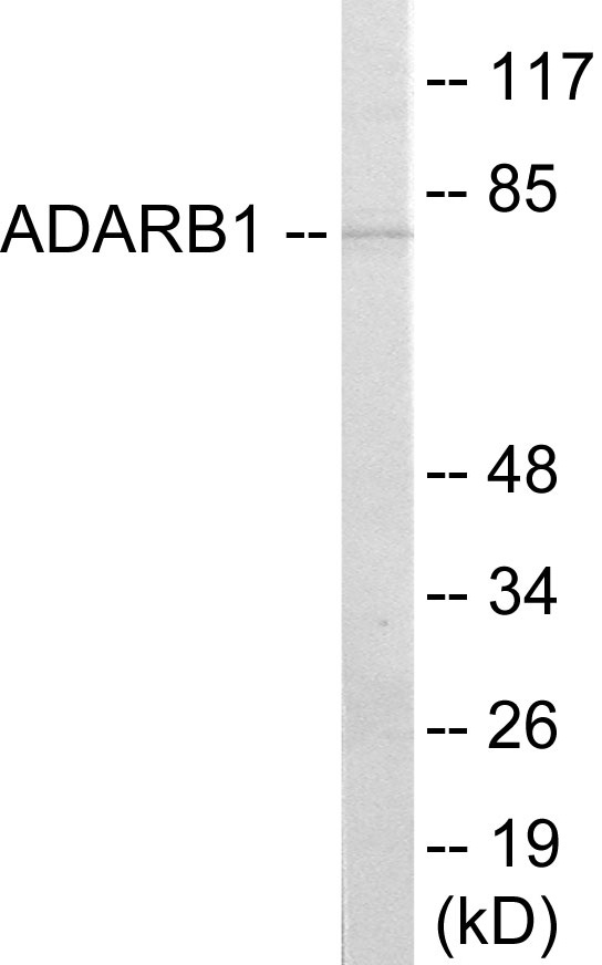 ADARB1 Cell Based ELISA Kit