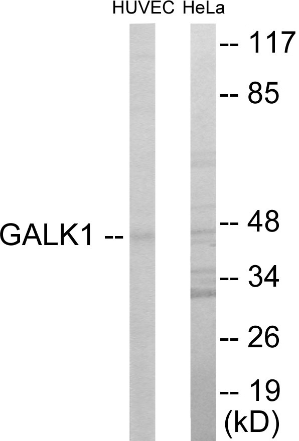 GALK1 Cell Based ELISA Kit