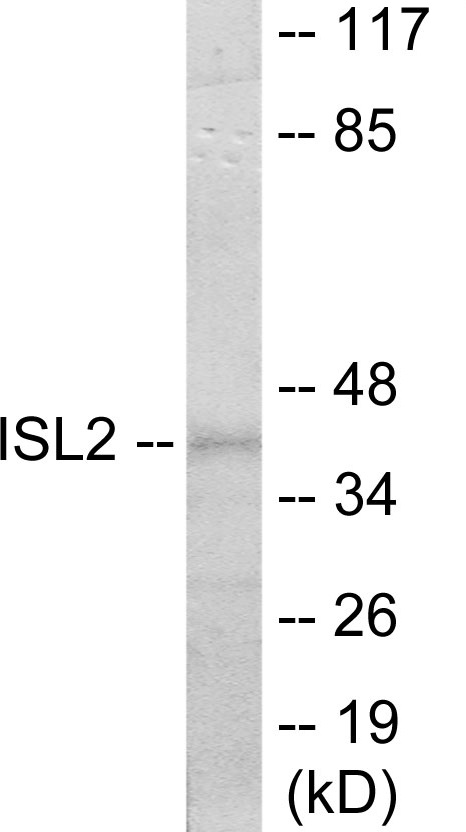 ISL2 Cell Based ELISA Kit