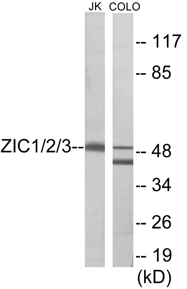 ZIC1 + 2 + 3 Cell Based ELISA Kit