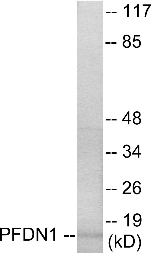 PFDN1 Cell Based ELISA Kit