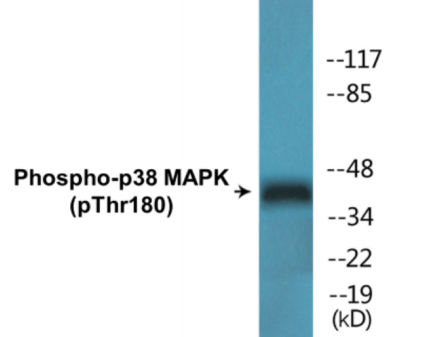 p38 MAPK (phospho Thr180) Cell Based ELISA Kit