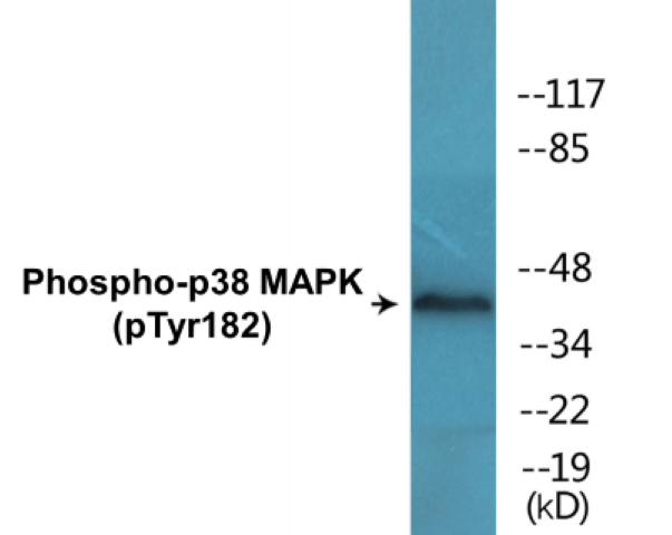 p38 MAPK (phospho Tyr182) Cell Based ELISA Kit