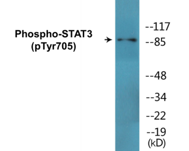 STAT3 (phospho Tyr705) Cell Based ELISA Kit