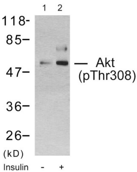 Akt (phospho Thr308) Cell Based ELISA Kit