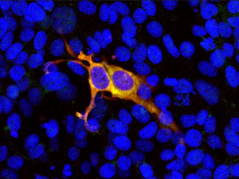 Anti-CRISPR-Cas9 Antibody