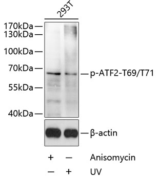 Anti-ATF2 (phospho Thr69 + Thr71) Antibody