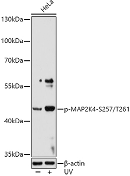 Anti-MEK4 / MKK4 (phospho Ser257 + Thr261) Antibody